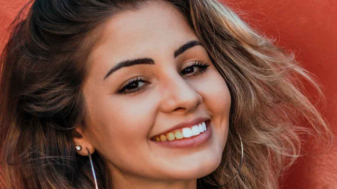 teeth whitening teeth-whitening